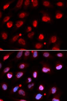 RNF2 / RING2 / RING1B Antibody - Immunofluorescence analysis of U20S cell using RNF2 antibody. Blue: DAPI for nuclear staining.