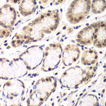 RNF2 / RING2 / RING1B Antibody - Immunohistochemistry of paraffin-embedded human colon tissue.