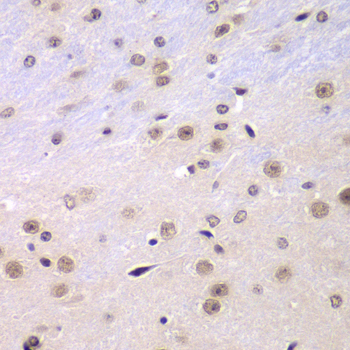 RNF2 / RING2 / RING1B Antibody - Immunohistochemistry of paraffin-embedded mouse brain tissue.