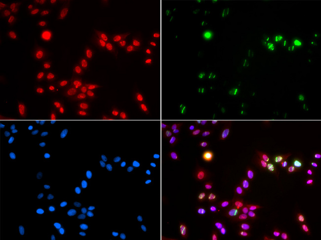 RNF2 / RING2 / RING1B Antibody - Immunofluorescence analysis of GFP-RNF168 transgenic U2OS cells.