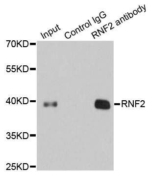 RNF2 / RING2 / RING1B Antibody - Immunoprecipitation analysis of 200ug extracts of 293T cells.