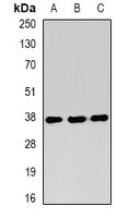 RNF2 / RING2 / RING1B Antibody - Western blot analysis of RING1b expression in Jurkat (A); SHSY5Y (B); mouse testis (C) whole cell lysates.