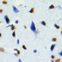 RNF2 / RING2 / RING1B Antibody - Immunohistochemical analysis of RING1b staining in mouse brain formalin fixed paraffin embedded tissue section. The section was pre-treated using heat mediated antigen retrieval with sodium citrate buffer (pH 6.0). The section was then incubated with the antibody at room temperature and detected using an HRP conjugated compact polymer system. DAB was used as the chromogen. The section was then counterstained with hematoxylin and mounted with DPX.