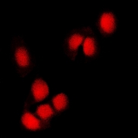 RNF2 / RING2 / RING1B Antibody - Immunofluorescent analysis of RING1b staining in U2OS cells. Formalin-fixed cells were permeabilized with 0.1% Triton X-100 in TBS for 5-10 minutes and blocked with 3% BSA-PBS for 30 minutes at room temperature. Cells were probed with the primary antibody in 3% BSA-PBS and incubated overnight at 4 deg C in a humidified chamber. Cells were washed with PBST and incubated with a DyLight 594-conjugated secondary antibody (red) in PBS at room temperature in the dark.