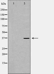 RNF2 / RING2 / RING1B Antibody - Western blot analysis of K562 whole cells lysates using RNF2 antibody. The lane on the left is treated with the antigen-specific peptide.