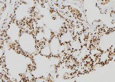 RNF2 / RING2 / RING1B Antibody - 1:100 staining rat lung tissue by IHC-P. The sample was formaldehyde fixed and a heat mediated antigen retrieval step in citrate buffer was performed. The sample was then blocked and incubated with the antibody for 1.5 hours at 22°C. An HRP conjugated goat anti-rabbit antibody was used as the secondary.