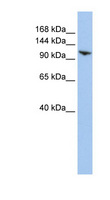 RNF20 Antibody - RNF20 antibody Western blot of HepG2 cell lysate. This image was taken for the unconjugated form of this product. Other forms have not been tested.