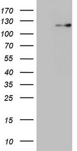 RNF20 Antibody - HEK293T cells were transfected with the pCMV6-ENTRY control. (Left lane) or pCMV6-ENTRY RNF20. (Right lane) cDNA for 48 hrs and lysed. Equivalent amounts of cell lysates. (5 ug per lane) were separated by SDS-PAGE and immunoblotted with anti-RNF20. (1:500)