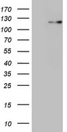 RNF20 Antibody - HEK293T cells were transfected with the pCMV6-ENTRY control. (Left lane) or pCMV6-ENTRY RNF20. (Right lane) cDNA for 48 hrs and lysed
