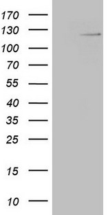 RNF20 Antibody - HEK293T cells were transfected with the pCMV6-ENTRY control. (Left lane) or pCMV6-ENTRY RNF20. (Right lane) cDNA for 48 hrs and lysed. Equivalent amounts of cell lysates. (5 ug per lane) were separated by SDS-PAGE and immunoblotted with anti-RNF20. (1:500)