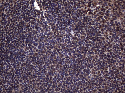 RNF20 Antibody - Immunohistochemical staining of paraffin-embedded Human tonsil within the normal limits using anti-RNF20 mouse monoclonal antibody. (Heat-induced epitope retrieval by 1mM EDTA in 10mM Tris buffer. (pH8.5) at 120°C for 3 min. (1:150)
