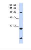 RNF20 Antibody - MCF7 cell lysate. Antibody concentration: 1.0 ug/ml. Gel concentration: 6-18%.  This image was taken for the unconjugated form of this product. Other forms have not been tested.