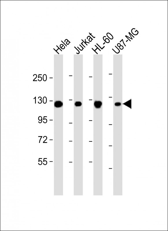 RNF20 Antibody - All lanes: Anti-RNF20 Antibody at 1:2000 dilution. Lane 1: HeLa whole cell lysate. Lane 2: Jurkat whole cell lysate. Lane 3: HL-60 whole cell lysate. Lane 4: U87-MG whole cell lysate Lysates/proteins at 20 ug per lane. Secondary Goat Anti-mouse IgG, (H+L), Peroxidase conjugated at 1:10000 dilution. Predicted band size: 114 kDa. Blocking/Dilution buffer: 5% NFDM/TBST.