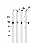 RNF20 Antibody - All lanes: Anti-RNF20 Antibody at 1:2000 dilution. Lane 1: HeLa whole cell lysate. Lane 2: Jurkat whole cell lysate. Lane 3: HL-60 whole cell lysate. Lane 4: U87-MG whole cell lysate Lysates/proteins at 20 ug per lane. Secondary Goat Anti-mouse IgG, (H+L), Peroxidase conjugated at 1:10000 dilution. Predicted band size: 114 kDa. Blocking/Dilution buffer: 5% NFDM/TBST.