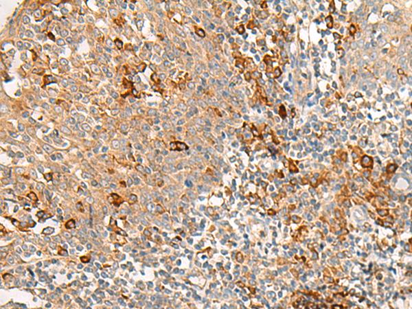 RNF207 Antibody - Immunohistochemistry of paraffin-embedded Human tonsil tissue  using RNF207 Polyclonal Antibody at dilution of 1:40(×200)
