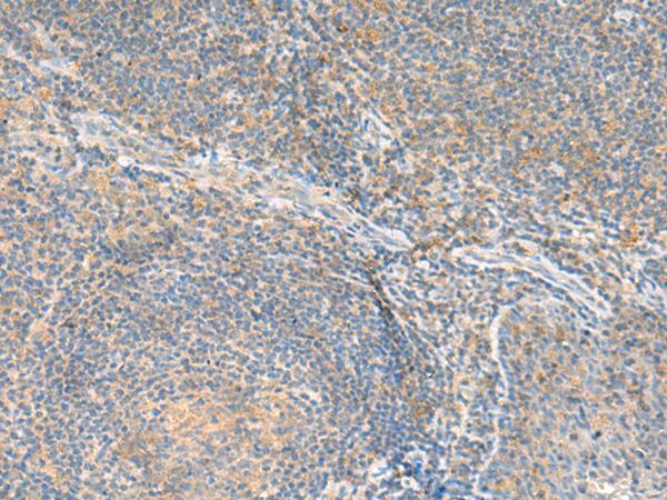 RNF207 Antibody - Immunohistochemistry of paraffin-embedded Human tonsil tissue  using RNF207 Polyclonal Antibody at dilution of 1:80(×200)
