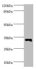 RNF212 Antibody - Western blot All lanes: RNF212 antibody at 14µg/ml + HepG2 whole cell lysate Secondary Goat polyclonal to rabbit IgG at 1/10000 dilution Predicted band size: 34, 15, 22, 32, 27, 31 kDa Observed band size: 34 kDa