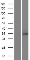 RNF212 Protein - Western validation with an anti-DDK antibody * L: Control HEK293 lysate R: Over-expression lysate