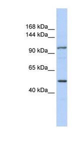 RNF213 Antibody - RNF213 antibody western blot of HeLa lysate.  This image was taken for the unconjugated form of this product. Other forms have not been tested.