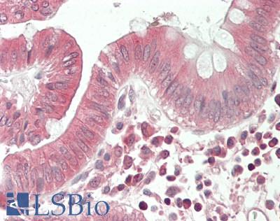 RNF213 Antibody - Human Colon: Formalin-Fixed, Paraffin-Embedded (FFPE).  This image was taken for the unconjugated form of this product. Other forms have not been tested.