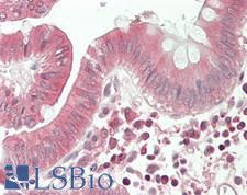 RNF213 Antibody - Human Colon: Formalin-Fixed, Paraffin-Embedded (FFPE).  This image was taken for the unconjugated form of this product. Other forms have not been tested.