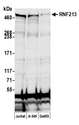 RNF213 Antibody - Detection of human RNF213 by western blot. Samples: Whole cell lysate (50 µg) from Jurkat, A-549, and GaMG cells prepared using NETN lysis buffer. Antibody: Affinity purified rabbit anti-RNF213 antibody used for WB at 1:1000. Detection: Chemiluminescence with an exposure time of 10 seconds.