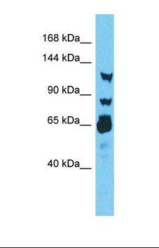 RNF213 Antibody - Western blot of Human Thyroid Tumor. RNF213 antibody dilution 1.0 ug/ml.  This image was taken for the unconjugated form of this product. Other forms have not been tested.
