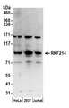RNF214 Antibody - Detection of human RNF214 by western blot. Samples: Whole cell lysate (50 µg) from HeLa, HEK293T, and Jurkat cells prepared using NETN lysis buffer. Antibodies: Affinity purified rabbit anti-RNF214 antibody used for WB at 0.1 µg/ml. Detection: Chemiluminescence with an exposure time of 3 minutes.