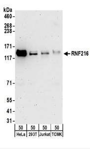 RNF216 / TRIAD3 Antibody - Detection of Human and Mouse RNF216 by Western Blot. Samples: Whole cell lysate (50 ug) from HeLa, 293T, Jurkat, and mouse TCMK-1 cells. Antibodies: Affinity purified rabbit anti-RNF216 antibody used for WB at 0.4 ug/ml. Detection: Chemiluminescence with an exposure time of 3 minutes.
