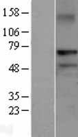 RNF220 / C1orf164 Protein - Western validation with an anti-DDK antibody * L: Control HEK293 lysate R: Over-expression lysate