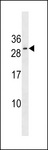 RNF223 Antibody - RNF223 Antibody western blot of T47D cell line lysates (35 ug/lane). The RNF223 antibody detected the RNF223 protein (arrow).