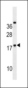 RNF224 Antibody - RNF224 Antibody western blot of HeLa cell line lysates (35 ug/lane). The RNF224 antibody detected the RNF224 protein (arrow).