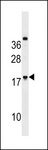 RNF224 Antibody - RNF224 Antibody western blot of HeLa cell line lysates (35 ug/lane). The RNF224 antibody detected the RNF224 protein (arrow).