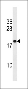 RNF24 Antibody - RNF24 Antibody western blot of mouse heart tissue lysates (35 ug/lane). The RNF24 antibody detected the RNF24 protein (arrow).