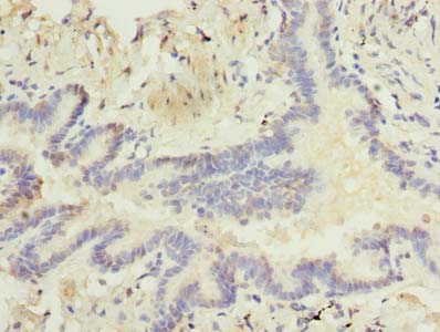 RNF24 Antibody - Immunohistochemistry of paraffin-embedded human lung tissue using antibody at dilution of 1:100.