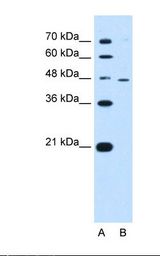 RNF25 Antibody - Lane A: Marker. Lane B: HepG2 cell lysate. Antibody concentration: 0.5 ug/ml. Gel concentration: 12%.  This image was taken for the unconjugated form of this product. Other forms have not been tested.