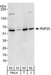 RNF25 Antibody - Detection of Human RNF25 by Western Blot. Samples: Whole cell lysate from HeLa (15 and 50 ug), 293T (T; 50 ug), and Jurkat (J; 50 ug) cells. Antibodies: Affinity purified rabbit anti-RNF25 antibody used for WB at 0.4 ug/ml. Detection: Chemiluminescence with an exposure time of 30 seconds.