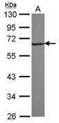 RNF25 Antibody - Sample (30 ug of whole cell lysate) A: Jurkat 10% SDS PAGE RNF25 antibody diluted at 1:1000