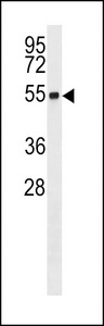 RNF26 Antibody - RNF26 Antibody western blot of Y79 cell line lysates (35 ug/lane). The RNF26 antibody detected the RNF26 protein (arrow).