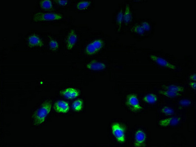 RNF26 Antibody - Immunofluorescent analysis of HepG2 cells using RNF26 Antibody at dilution of 1:100 and Alexa Fluor 488-congugated AffiniPure Goat Anti-Rabbit IgG(H+L)