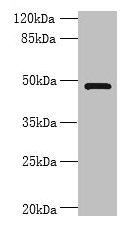 RNF26 Antibody - Western blot All lanes: RNF26 antibody at 6µg/ml + 293T whole cell lysate Secondary Goat polyclonal to rabbit IgG at 1/10000 dilution Predicted band size: 48 kDa Observed band size: 48 kDa