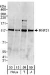 RNF31 Antibody - Detection of Human RNF31 by Western Blot. Samples: Samples: Whole cell lysate from HeLa (15 and 50 ug), 293T (T; 50 ug) and Jurkat (J; 50 ug) cells. Antibodies: Affinity purified rabbit anti-RNF31 antibody used for WB at 0.4 ug/ml. Detection: Chemiluminescence with an exposure time of 3 minutes.