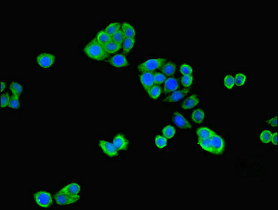 RNF31 Antibody - Immunofluorescent analysis of PC-3 cells using RNF31 Antibody at dilution of 1:100 and Alexa Fluor 488-congugated AffiniPure Goat Anti-Rabbit IgG(H+L)