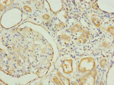 RNF31 Antibody - Immunohistochemistry of paraffin-embedded human kidney tissue using RNF31 Antibody at dilution of 1:100
