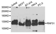 RNF31 Antibody - Western blot analysis of extracts of various cell lines.