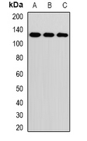 RNF31 Antibody - Western blot analysis of RNF31 expression in MCF7 (A); HeLa (B); PC3 (C) whole cell lysates.
