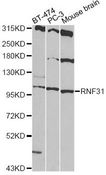 RNF31 Antibody - Western blot analysis of extracts of various cell lines, using RNF31 antibody at 1:1000 dilution. The secondary antibody used was an HRP Goat Anti-Rabbit IgG (H+L) at 1:10000 dilution. Lysates were loaded 25ug per lane and 3% nonfat dry milk in TBST was used for blocking. An ECL Kit was used for detection and the exposure time was 90s.
