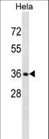 RNF34 Antibody - RNF34 Antibody western blot of HeLa cell line lysates (35 ug/lane). The RNF34 antibody detected the RNF34 protein (arrow).