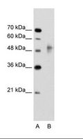 RNF38 Antibody - A: Marker, B: Jurkat Cell Lysate.  This image was taken for the unconjugated form of this product. Other forms have not been tested.