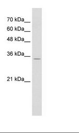 RNF39 Antibody - Jurkat Cell Lysate.  This image was taken for the unconjugated form of this product. Other forms have not been tested.